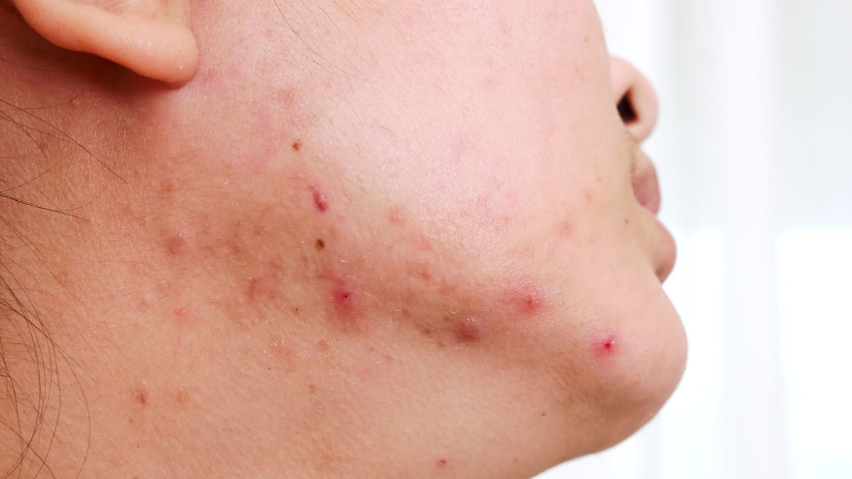 collagen for ageing skin menopause