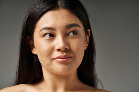 Can Collagen Cause Acne?