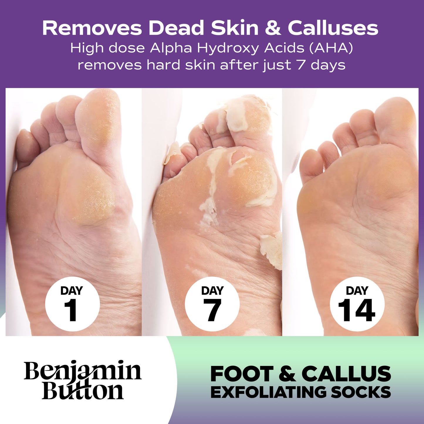 Exfoliating Foot Mask 5-Pack